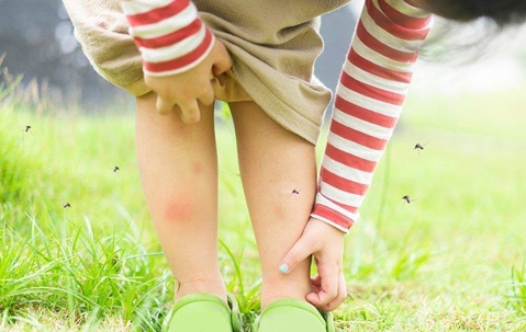 mosquitoes on child's leg